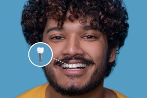 Smile Renewed: Exploring the World of Dental Implants